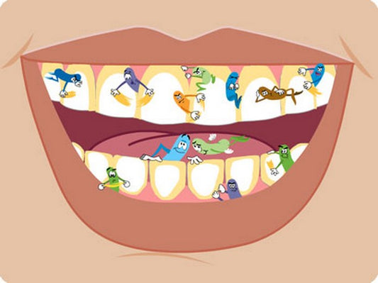 Wat is tandsteen eigenlijk?